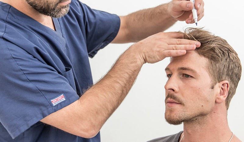 دارو درمانی جلوگیری از ریزش مو چیست