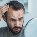 درمان ریزش مو هورمونی مردان
